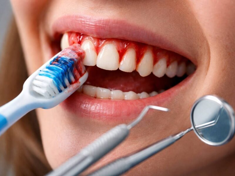 Sensitive Gum Areas: Use Gentler Brushing and Get Them Evaluated